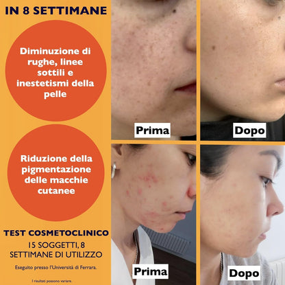 Organic Vitamin C Serum for Face with Hyaluronic Acid. Anti-Aging, Wrinkles, Dark Spots, Brightening and Vegan Vitamin C Serum for Facial Skin Care. Eye Cream Suitable. For Women and Men - Big 2.11oz